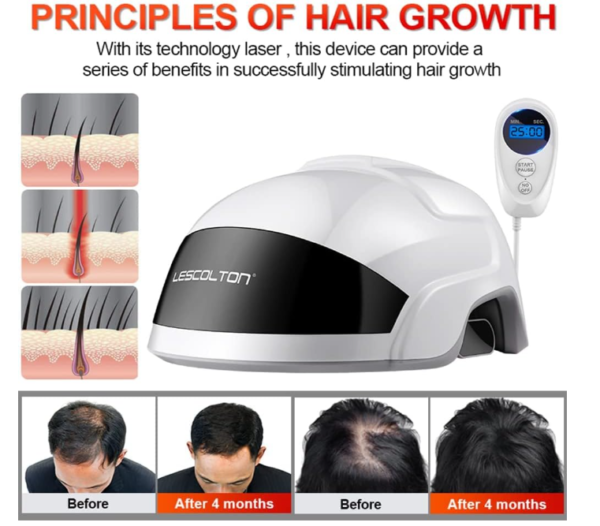 Hair Growth System For Men & Women - Image 4